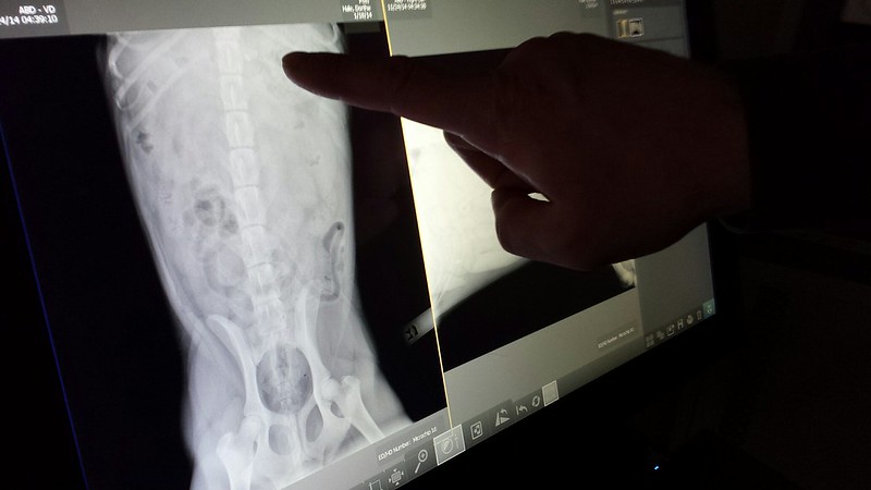 Dr. VET points out the small stone in an X ray - Posie swallowed, West Olympia Animal Hospital,  West Olympia, Washington, USA