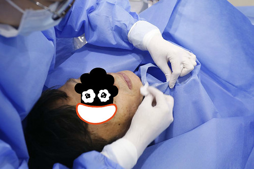 還在擔心植牙過程很恐怖嗎？絕美牙醫陳冠靜醫師給你最專業的植牙服務 (8)