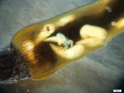 High resolution photo of gregarine parasites within a damselfly epithelium. 