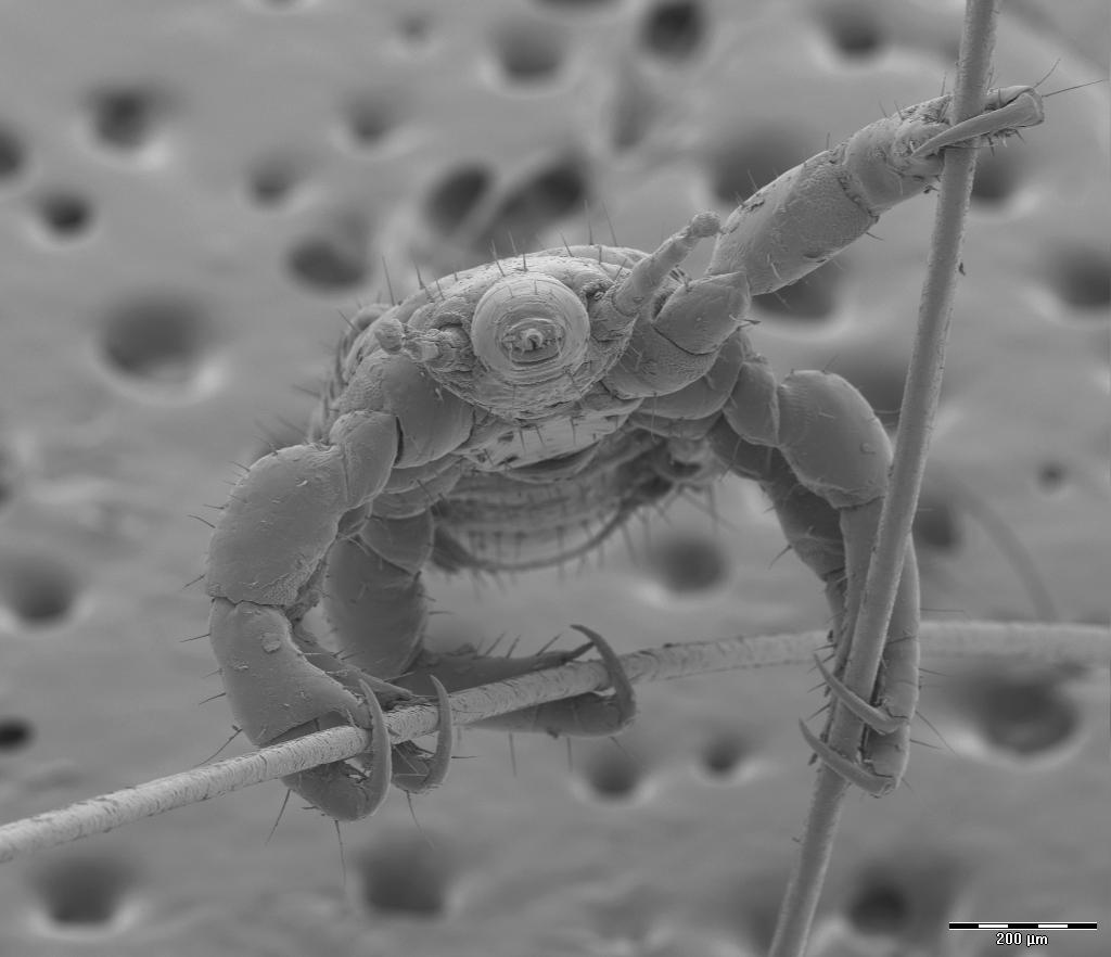 Head lice | Lice olympics (pole vault). Head lice on two hum… | Flickr
