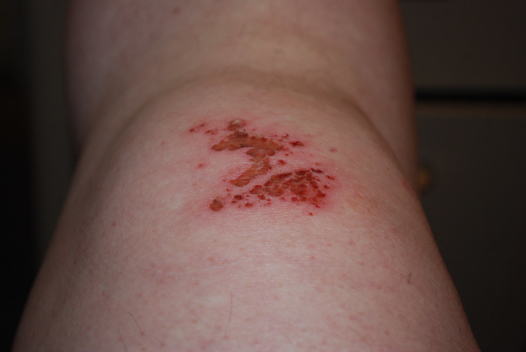 Wound On My Cat Looks Like Rupture Wound On My Cat Looks Like Rupture