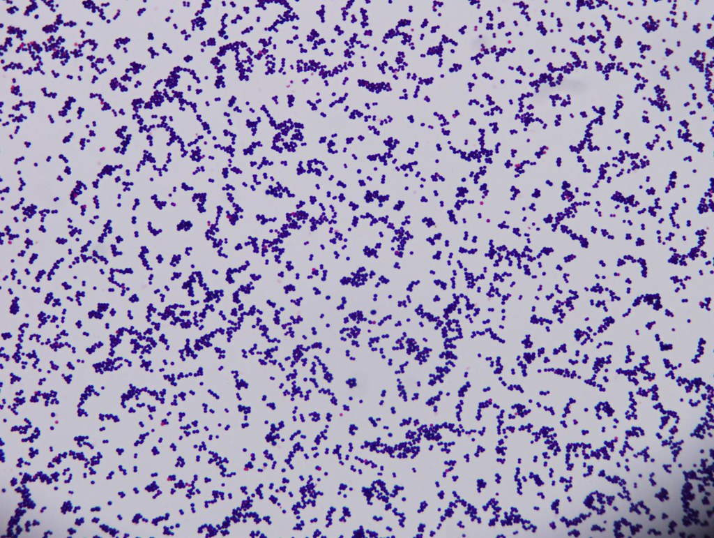 Микропрепарат бактерий. Стафилококк Интермедиус. Эпидермальный стафилококк микроскопия. Золотистый стафилококк микроскопия. Эпидермальный стафилококк (Staph.epidermidis).