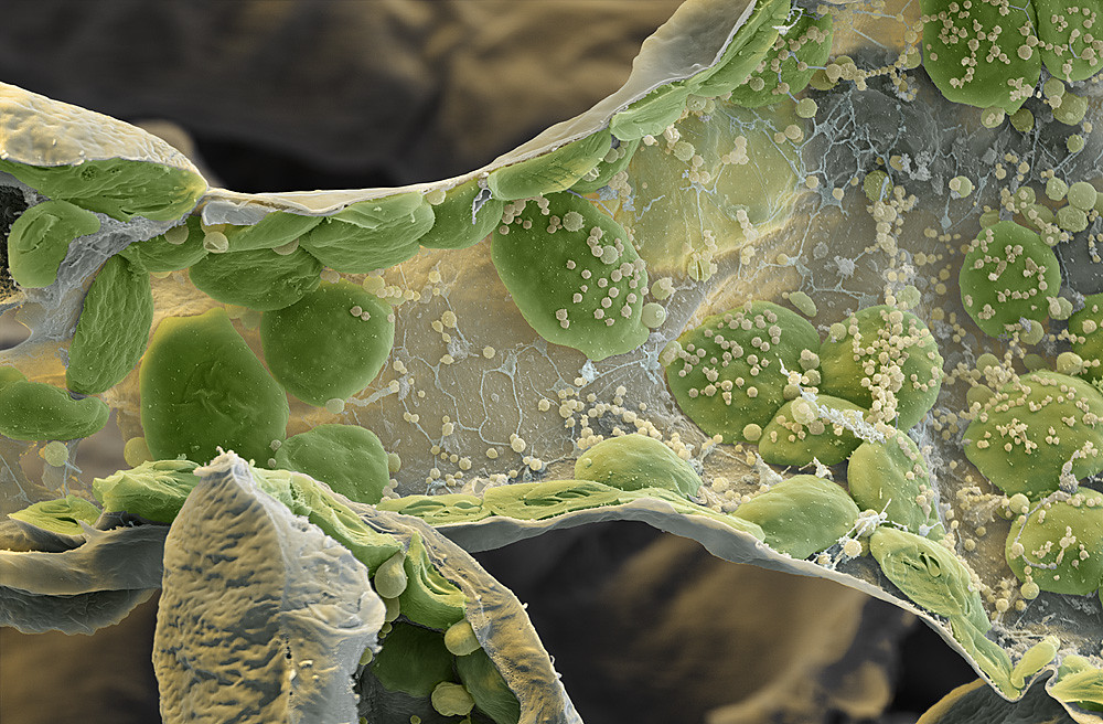 chloroplasts-chloroplasten-the-green-chloroplasts-in-the-flickr