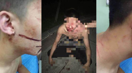 Northeast Dianli University-night run of three examinees were beaten, the police characterized as a criminal case