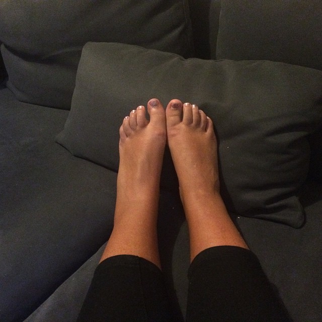 I have chubby ankles but the swelling on the left is out of control. Sigh.